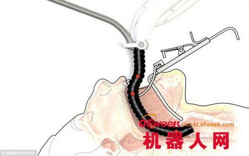 蛇形机器人可钻入患者体内实施手术