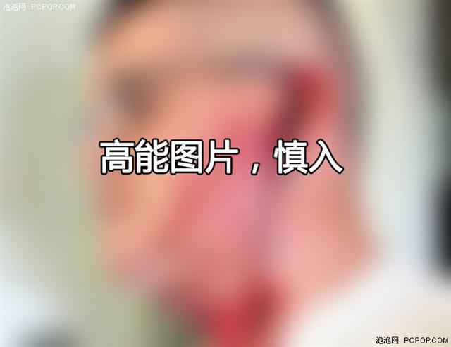 技术全解析：为何锂电池爆炸新闻不断