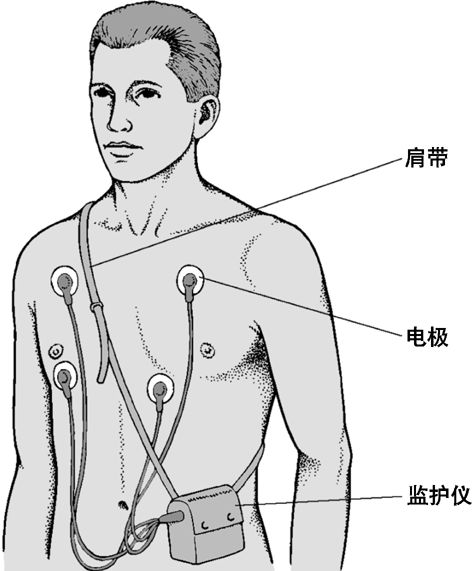 谷歌发布最新“穿戴式心电图设备”